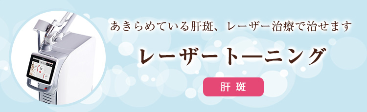 レーザートーニング