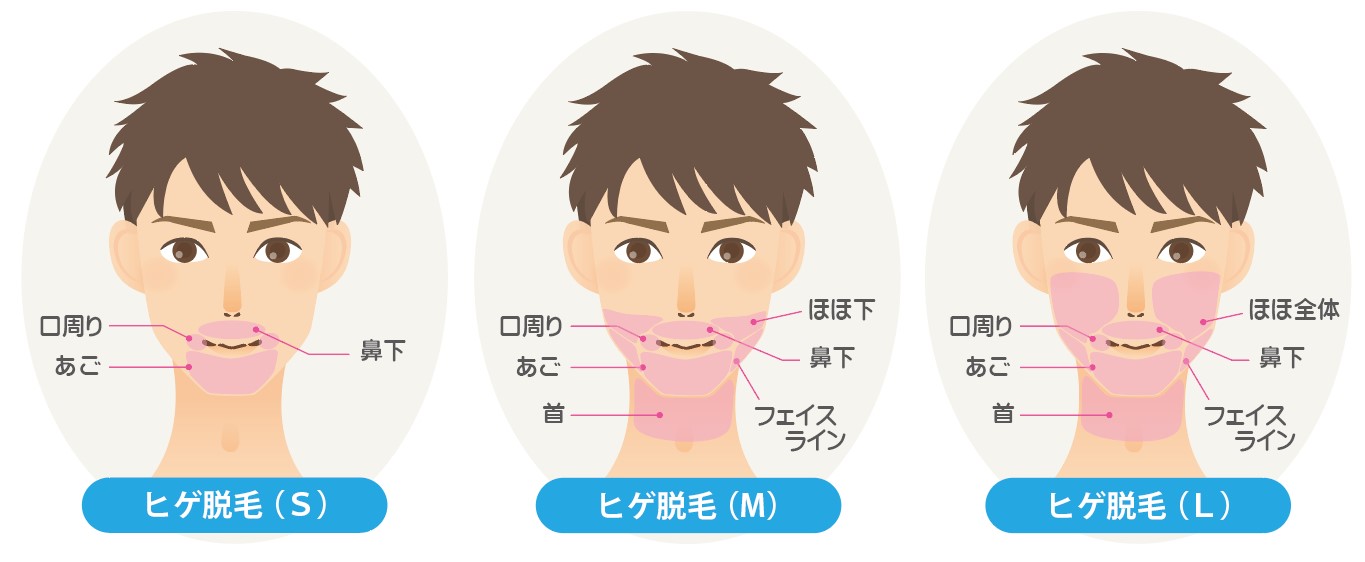 男性ヒゲ脱毛(フォーマLLD)