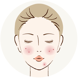 ニキビ・赤ら顔